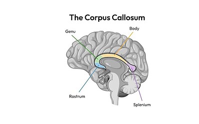 What Is the Corpus Callosum? Function, Location, and Why It Matters