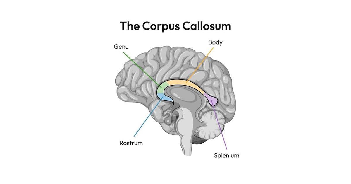 what is the corpus callosum